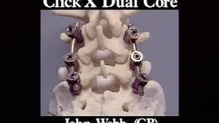 AO spine Instrumentation