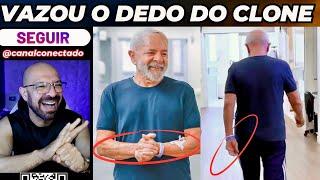 O dedo do clone do Lula.