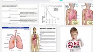 111 mesothelioma class action lawsuit