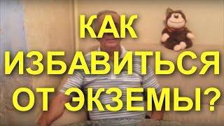 #ЭКЗЕМА НА РУКАХ? ЗНАЕМ КАК ВЫЛЕЧИТЬ ЭКЗЕМУ!