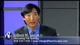 Fat Grafting with San Diego, CA Plastic Surgeon, Gilbert Lee, M D