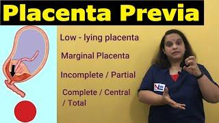 Placenta Previa | APH | Antepartum Hemorrhage-Types, Risk factors, Signs, Symptoms | Nursing Lecture