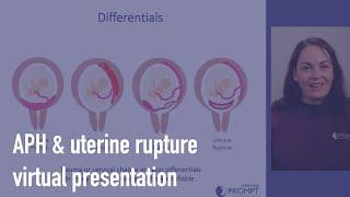 Antepartum haemorrhage & uterine rupture