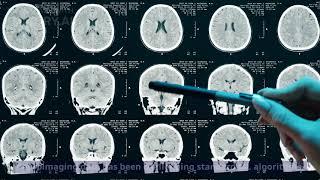 A novel decoding Python package for high-dimensional neuroimaging data