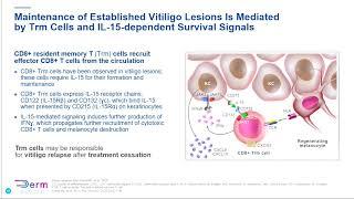 Controversies & Challenges in the Pathophysiology of Vitiligo​Interview and audience Q&A​