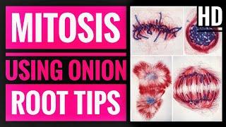 Onion root tip mitosis experiment and observation of stages