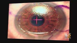 Doctors Warn Of Complications Surrounding LASIK Eye Surgery