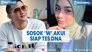 Sosok W yang Mengaku Punya Anak dari Rezky Adhitya, Ungkap Siap Tes DNA