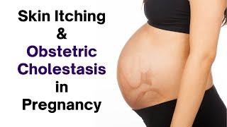 Pregnancy Itching? Discover Causes and Natural Relief Methods!