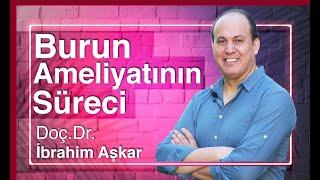 Burun Estetiği Ameliyat Süreci  / Doç. Dr. İbrahim Aşkar