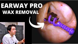 EARWAY PRO Ear Wax Extraction