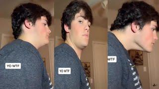 Tiktok hack: if you think you have a double chin. Must watch this