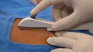Inserting a One Rod Implant, Teaching Short (Health Workers), English - Family Planning Series