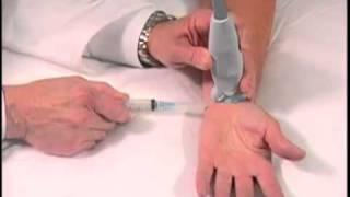 How To: Ultrasound Guided Carpal Tunnel Injection 3D Video