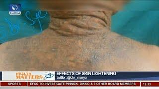 Skin Lightening Dangerous To Our Health, Dermatologist Highlights Negatives Pt.3 |Health Matters|