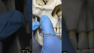 Third Molar Extraction Tip | OnlineExodontia.com | #odontologia #oralsurgery
