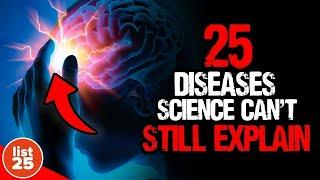 25 Mind Boggling Diseases That Science Can't Explain
