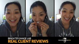 Brighter Image Lab Dental Veneer Reviews: Real Client Smile Makeovers - No Cosmetic Dentist Needed!