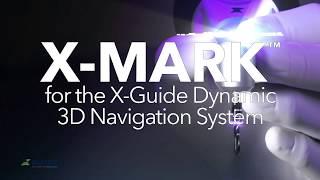 Introducing X-MARK Virtual Registration for X-Guide Dynamic 3D Navigated Implant Surgery