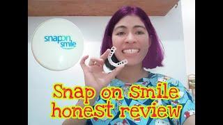 Snap on smile honest review