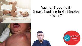 Vaginal Bleeding & Breast swelling in Girl Babies - Why ?