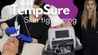 TempSure RF: The Non-Surgical Solution for Skin Tightening and Wrinkle Reduction