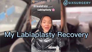 My Labiaplasty in Toronto with SixSurgery