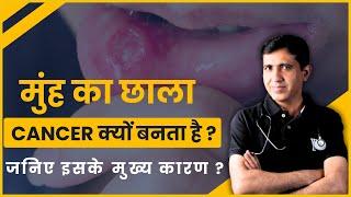 Mouth Ulcer कहीं मुंह के छाले कैंसर का रूप तो नहीं ले रहें ?