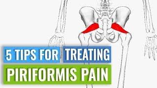 Treatment for Piriformis Pain