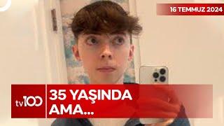 Yaş Alıyor Ama Yaşlanmıyor | TV100 Ana Haber