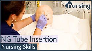 NG (Nasogastric) Tube Insertion Techniques (Nursing Skills)