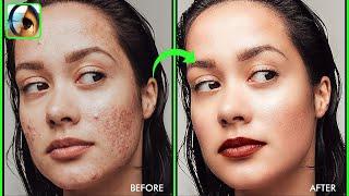 High-End Skin Retouching- Photoshop 7.0 Tutorial in Hindi/Urdu I Skin Retouching in Photoshop