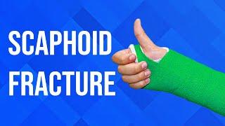 Scaphoid Fractures