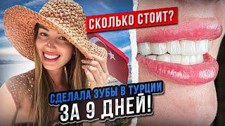 СДЕЛАЛА ЗУБЫ В ТУРЦИИ ЗА 9 ДНЕЙ/ СКОЛЬКО СТОЯТ ВИНИРЫ?