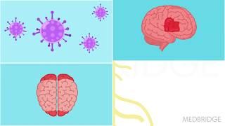 Neurogenesis and Developmental Disorders - Patricia Montgomery | MedBridge