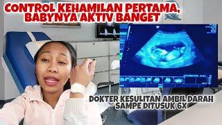 AKHIRNYA BISA LIAT SI BABY DAN TAU USIA KEHAMILAN