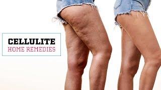 How To Get Rid Of Cellulite Naturally | Glamrs Skin Care