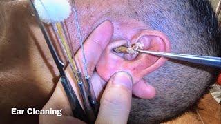 耳掃除 귀 청소 Ear Cleaning #298