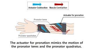 A Lightweight Soft Wearable Sleeve for Rehabilitation of Forearm Pronation and Supination