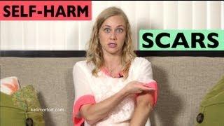 Hiding Self-Harm Scars?