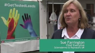 Scleroderma and Raynaud's UK testing for Raynaud's