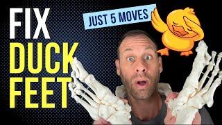 Fix Duck Feet with Just 5 Easy Moves!