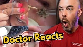 Dermatologist's Reaction to Viral Pimple Popping, Cyst Popping TikToks