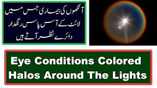 Eye Conditions Colored Halos Around The Lights | Urdu/Hindi