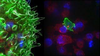 Killer T Cell: The Cancer Assassin