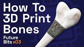 How To 3D Print Bones? - A Future Bit From The Medical Futurist