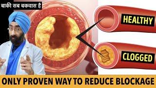 Only Proven Way To Clean Heart Blockage | Unclog Arteries | Do Statins Reverse plaque | Dr.Education