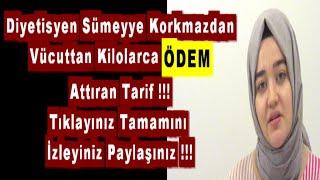 Diyetisyen Sümeyye Korkmazdan Vücuttan Kilolarca Ödem Attıran Tarif !!!