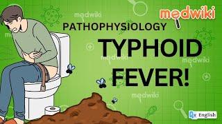 Pathophysiology of Typhoid Fever!