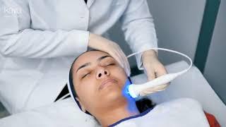 Kaya HydraFacial